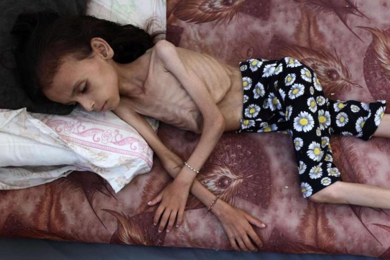 Malnutritian3 Malnutritian3